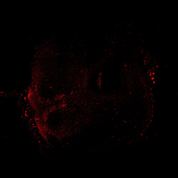 13PCW human midbrain